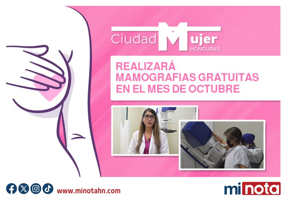 CIUDAD MUJER REALIZARÁ MAMOGRAFIAS GRATUITAS EN EL MES DE OCTUBRE